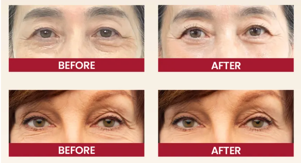 K-SECRET - SEOUL 1988 Eye Cream: Retinal Liposome 4% + Fermented Bean30 ML | Contorno de Ojos Antiedad