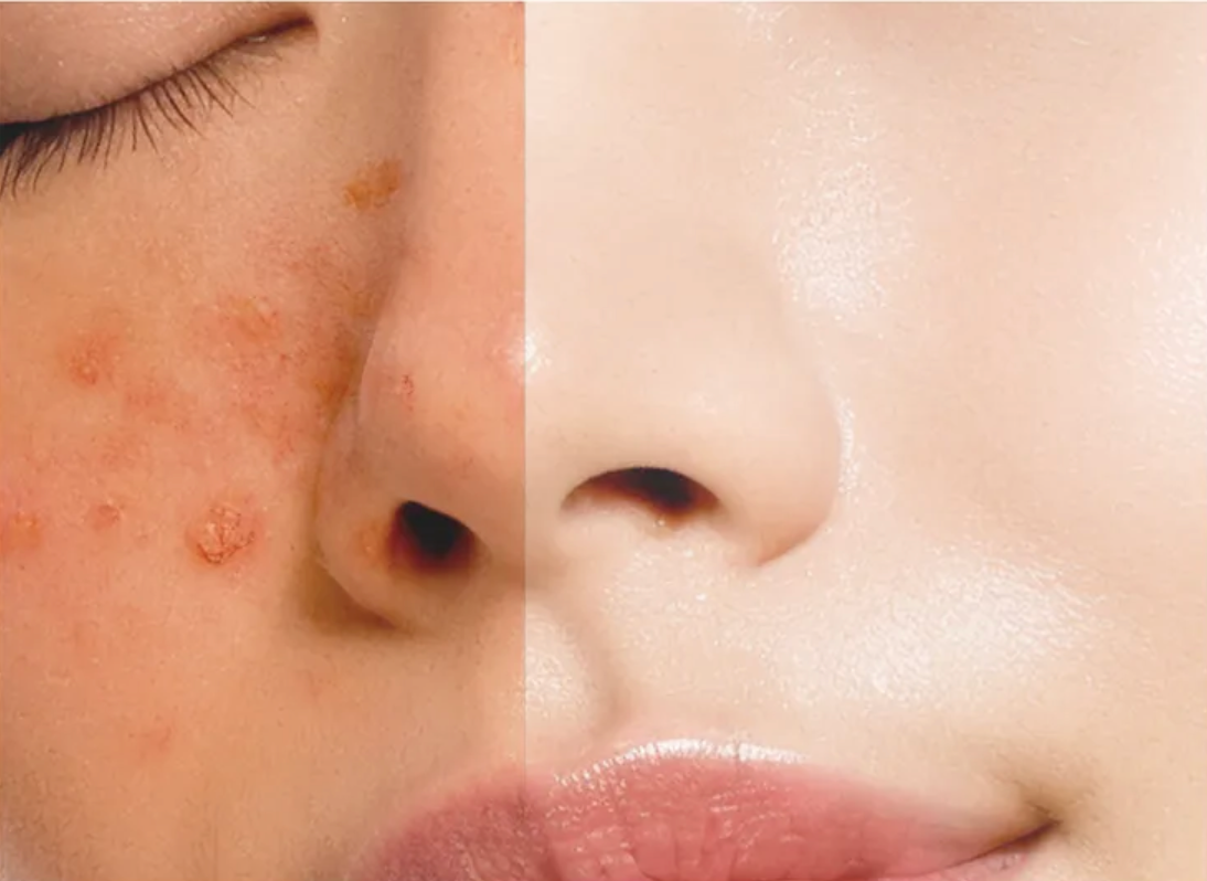 PURITO SEOUL - Mighty Bamboo Panthenol Cream 100 ML | Crema Hidratante Y Calmante