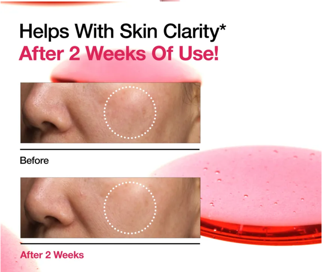 ANUA - Niacinamide 10% + TXA 4% Serum 30 ML | Suero Antimanchas