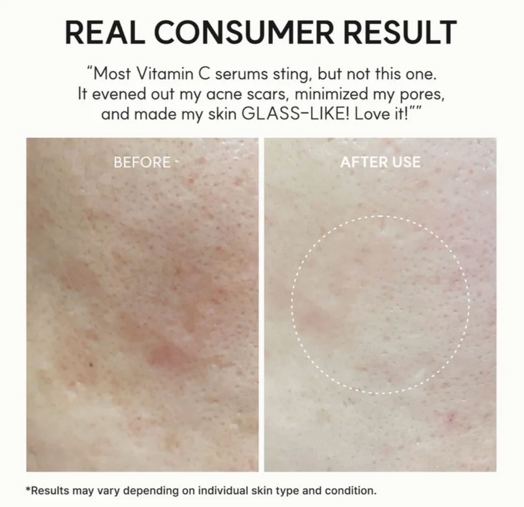 ARENCIA - Vitamin C Booster | Serum